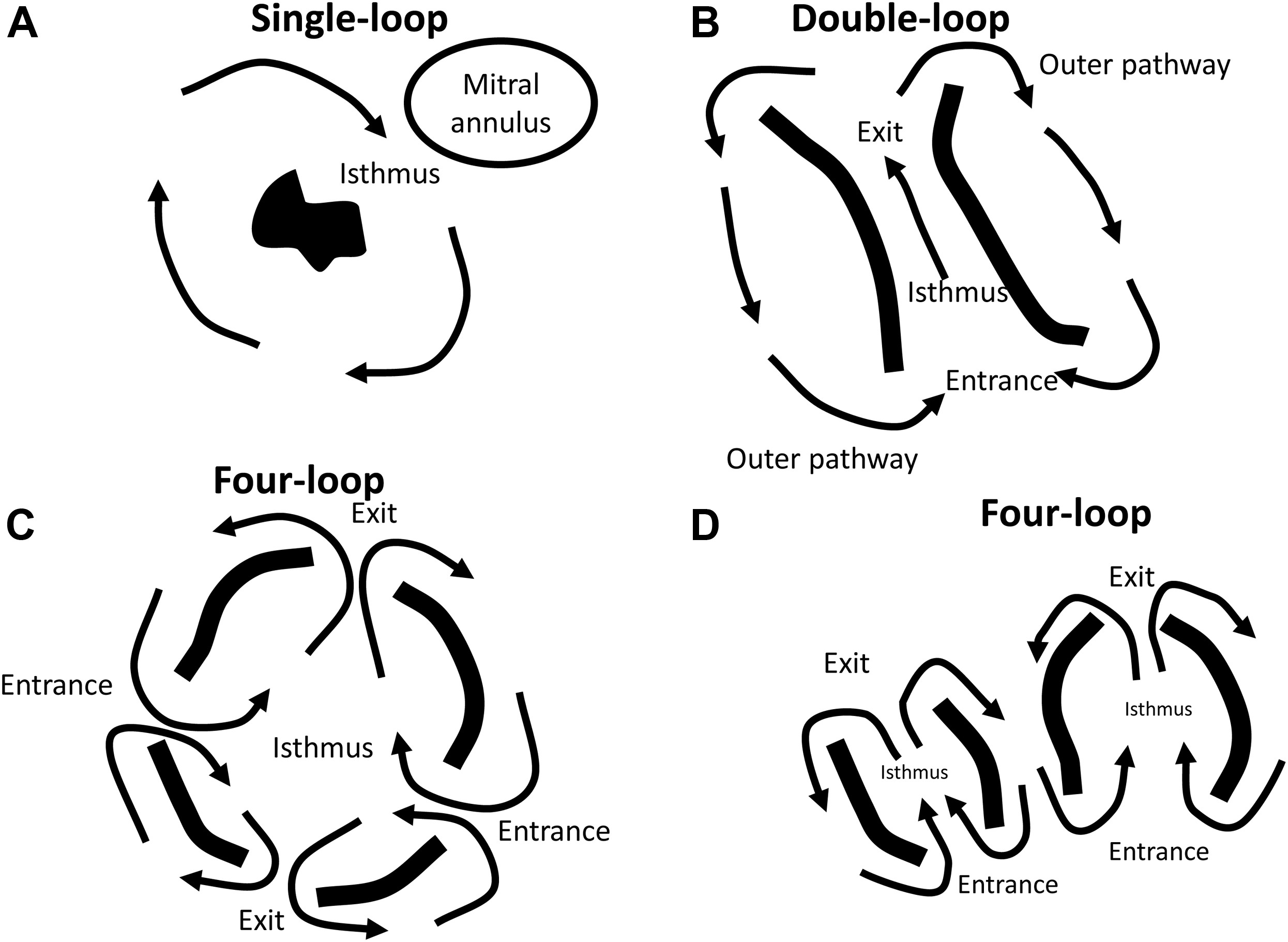 Schematic examples of single-loop, double-loop, and four-loop reentrant circuit patterns in arrhythmia
